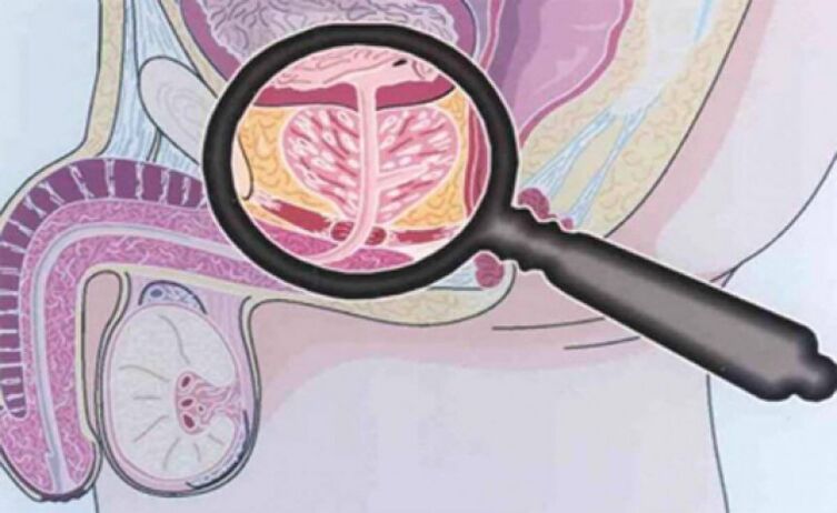 The prostate and its location